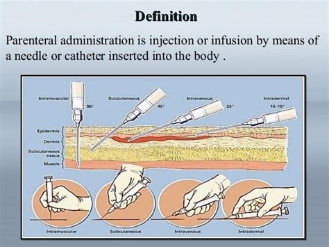 Sometimes a drug is given through the skin—by needle (subcutaneous, intramuscular, or intravenous route), by patch (transdermal route), or by implantation. For the subcutaneous route, a needle is inserted into fatty tissue just beneath the skin. After a drug is injected, it then moves into small blood vessels (capillaries) and is carried away ...